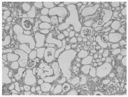 Séria Úvod do aktívnych folátových nečistôt: ① Odhalenie vplyvu kyseliny 5-metyltetrahydropterovej.